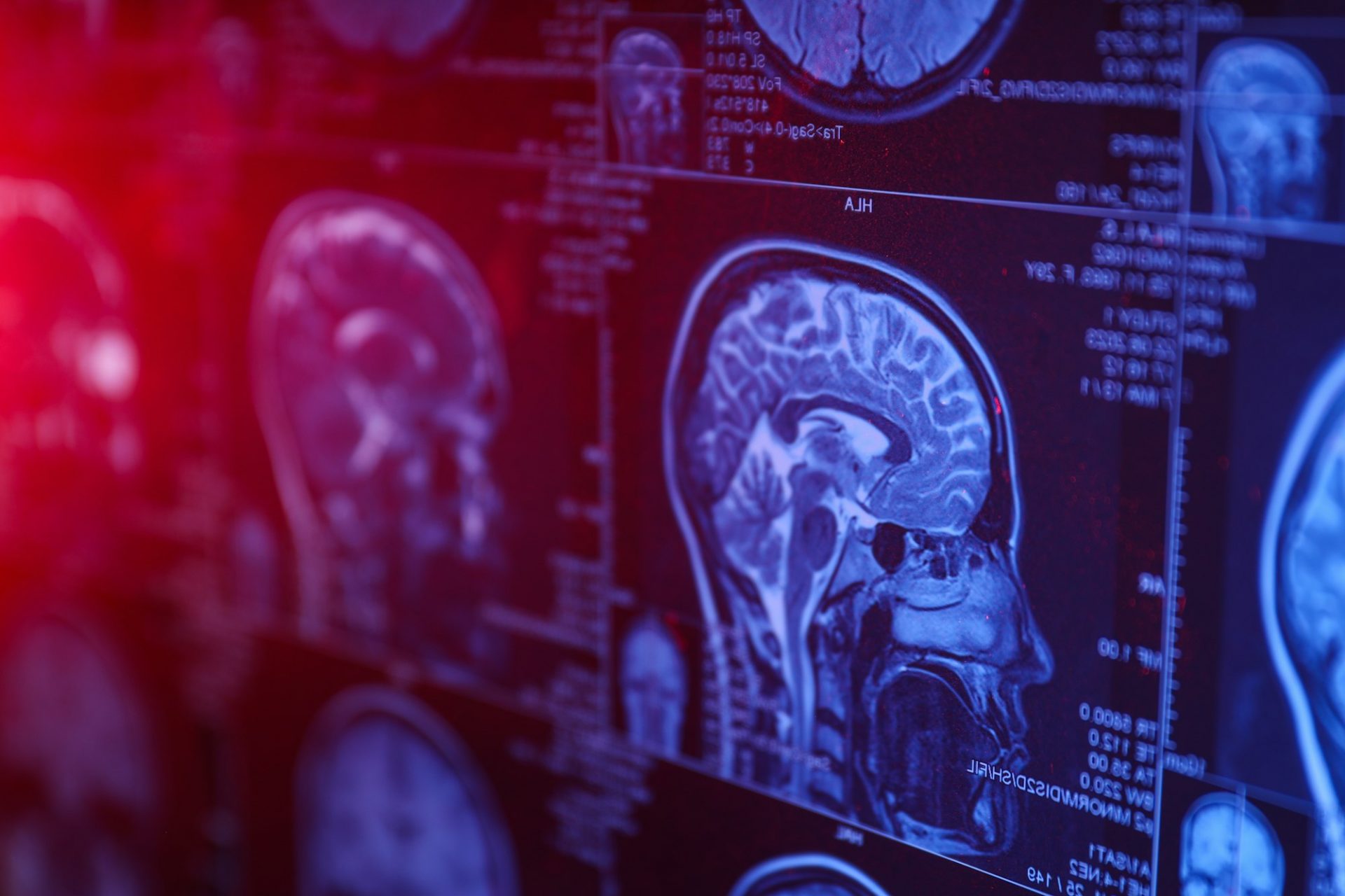 MRI or magnetic resonance imaging of the head and brain. Close up